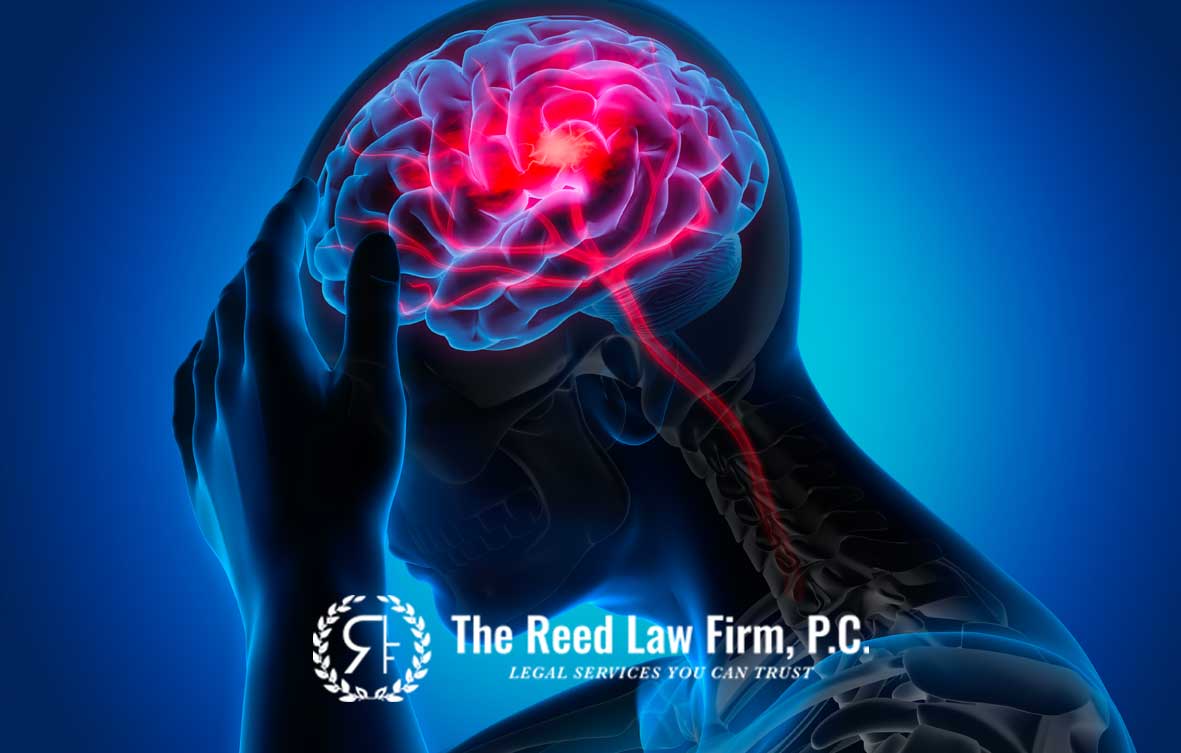 Personal Injury Risk of Traumatic Brain Due to Car Accident in Atlanta